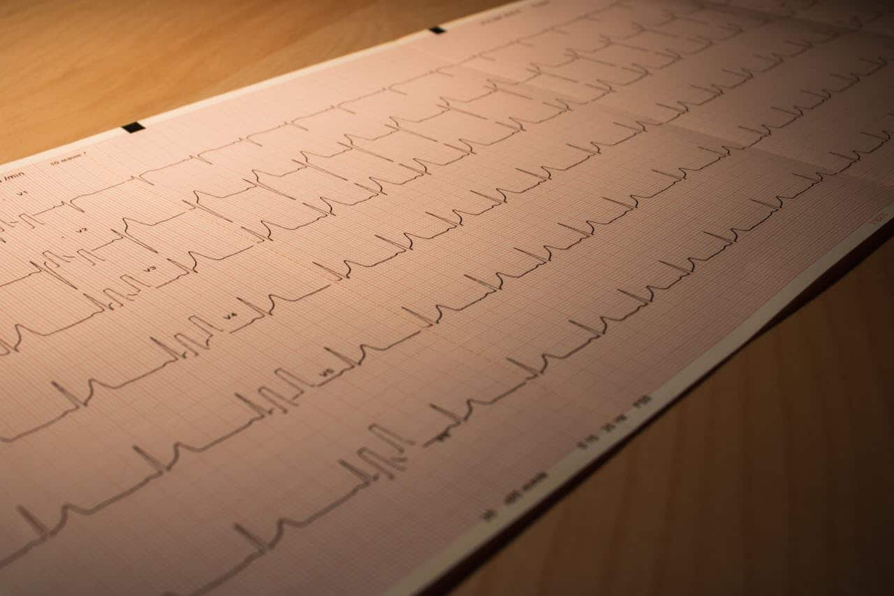 altijd op scherp 